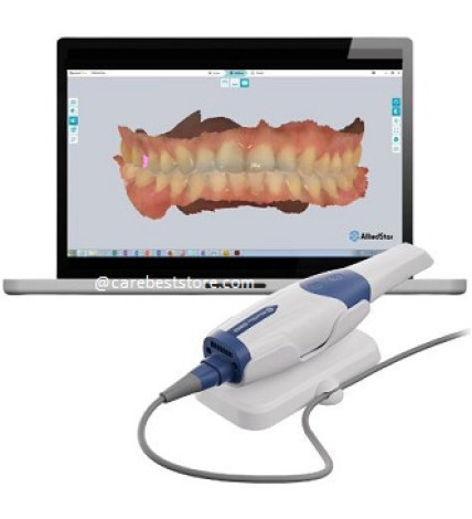 Alliedstar AS 260 Intraoral Scanner