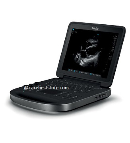 SonoSite Edge II Ultrasound Machine